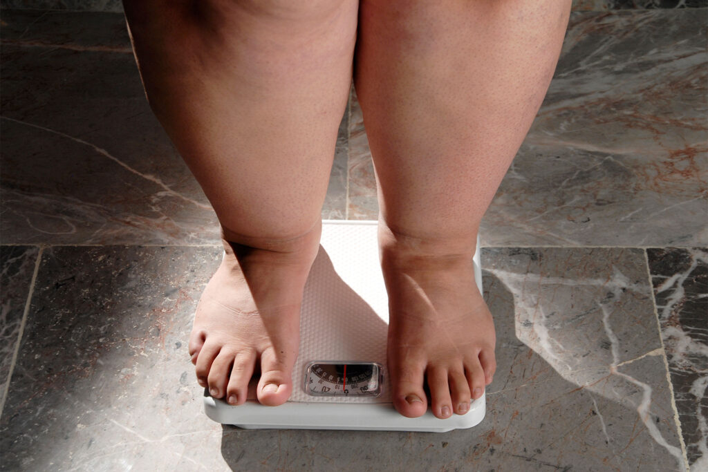 pessoa obesa se pesando